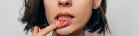 Entzündungen der Mundschleimhaut bei Krebsbehandlung